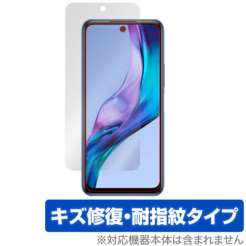 JAN 4525443492039 OverLay Magic for Xiaomi Redmi Note 10T 表面用保護シート 株式会社ミヤビックス スマートフォン・タブレット 画像