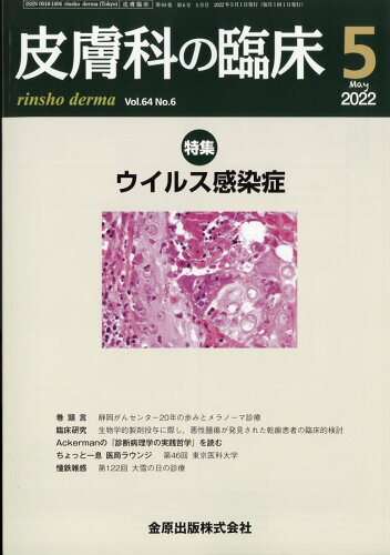 JAN 4910076370524 皮膚科の臨床 2022年 05月号 [雑誌]/金原出版 本・雑誌・コミック 画像