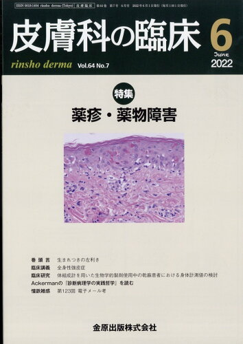 JAN 4910076370623 皮膚科の臨床 2022年 06月号 [雑誌]/金原出版 本・雑誌・コミック 画像