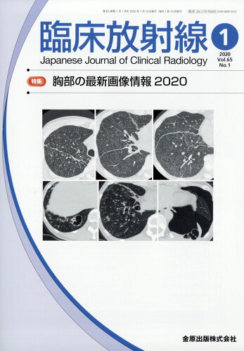 JAN 4910093490106 臨床放射線 2020年 01月号 [雑誌]/金原出版 本・雑誌・コミック 画像