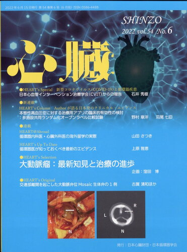 JAN 4910144110625 心臓 2022年 06月号 [雑誌]/日本医学出版 本・雑誌・コミック 画像