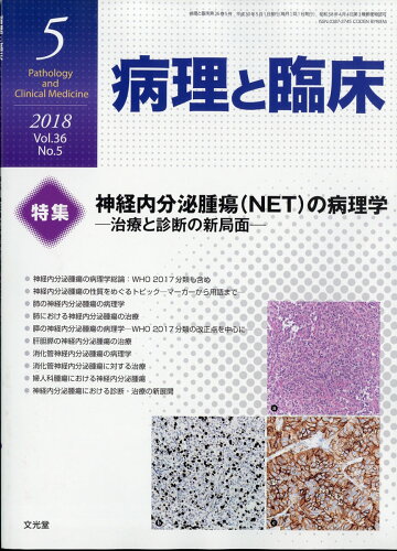 JAN 4910176930581 病理と臨床 2018年 05月号 [雑誌]/文光堂 本・雑誌・コミック 画像