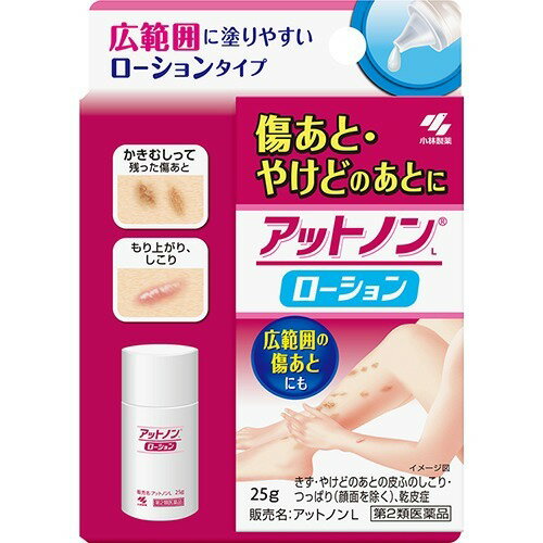 JAN 4987072042717 アットノンL ローション(25g) 小林製薬株式会社 医薬品・コンタクト・介護 画像