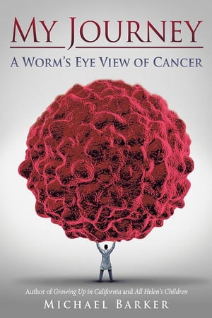 ISBN 9781491789131 My Journey: a Worm’S Eye View of Cancer Michael Barker 本・雑誌・コミック 画像