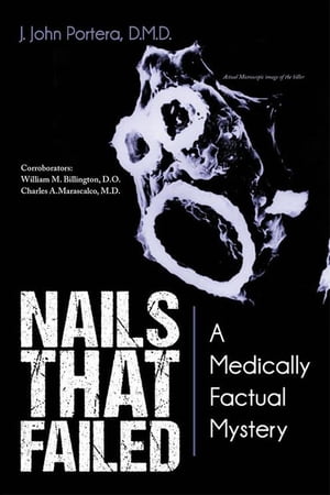 ISBN 9781491833025 Nails That FailedA Medically Factual Mystery 本・雑誌・コミック 画像