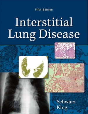 ISBN 9781607950240 INTERSTITIAL LUNG DISEASE 5/E(H)/OTHERS3/MARVIN I./KING SCHWARZ, TALMADGE E. 本・雑誌・コミック 画像