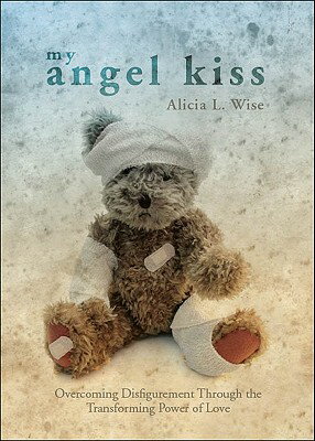 ISBN 9781616635978 My Angel Kiss: Overcoming Disfigurement Through the Transforming Power of Love/TATE PUB/Alicia L. Wise 本・雑誌・コミック 画像