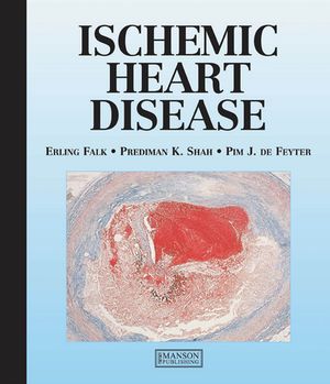 ISBN 9781840760521 Ischemic Heart Disease Erling Falk 本・雑誌・コミック 画像