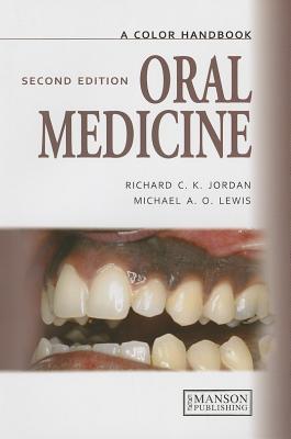 ISBN 9781840761894 Oral Medicine, Second Edition/MANSON PUB LTD/Michael A. O. Lewis 本・雑誌・コミック 画像