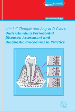 ISBN 9781850970538 Understanding Periodontal Diseases: Assessment and Diagnostic Procedures in Practice Iain L. C. Chapple 本・雑誌・コミック 画像