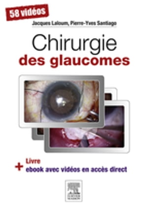 ISBN 9782294743757 Chirurgie des glaucomes Jacques LALOUM 本・雑誌・コミック 画像