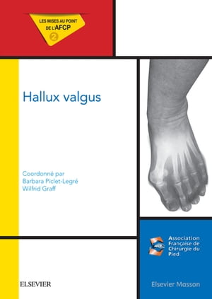 ISBN 9782294750663 Hallux valgusMises au point de l'AFCP Barbara Piclet-Legr? 本・雑誌・コミック 画像