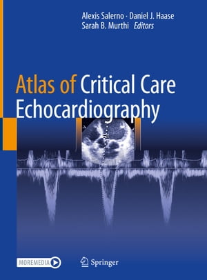 ISBN 9783030746858 Atlas of Critical Care Echocardiography 2021/SPRINGER NATURE/Alexis Salerno 本・雑誌・コミック 画像