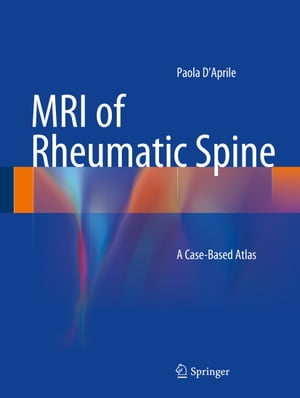 ISBN 9783319056265 MRI of Rheumatic Spine: A Case-Based Atlas 2014/SPRINGER VERLAG GMBH/Paola D'Aprile 本・雑誌・コミック 画像