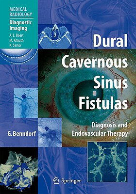 ISBN 9783540008187 Dural Cavernous Sinus Fistulas: Diagnosis and Endovascular Therapy/SPRINGER NATURE/Goetz Benndorf 本・雑誌・コミック 画像