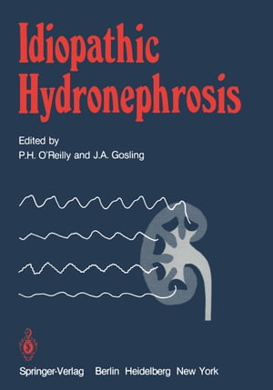 ISBN 9783540109372 Idiopathic Hydronephrosis 本・雑誌・コミック 画像