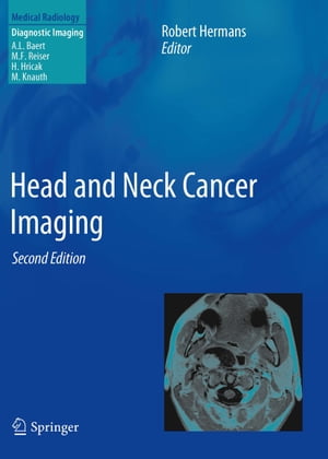 ISBN 9783642178689 Head and Neck Cancer Imaging 2012/SPRINGER NATURE/Robert Hermans 本・雑誌・コミック 画像