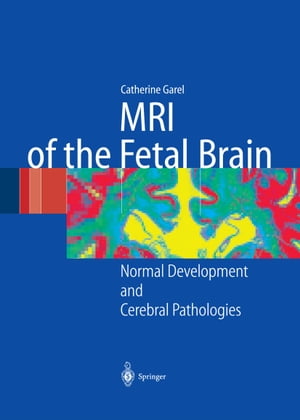 ISBN 9783642622755 MRI of the Fetal Brain Normal Development and Cerebral Pathologies C. Garel 本・雑誌・コミック 画像