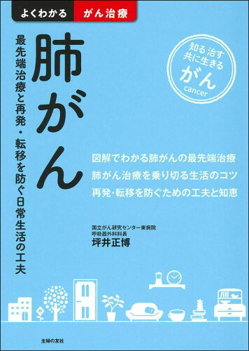 ISBN 9784074417384 肺がん 最先端治療と再発・転移を防ぐ日常生活の工夫  /主婦の友社/坪井正博 主婦の友社 本・雑誌・コミック 画像