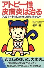 ISBN 9784079318105 アトピ-性皮膚炎は治る アレルギ-そのものを断つ注目の最新医学  /主婦の友社/権東明 主婦の友社 本・雑誌・コミック 画像