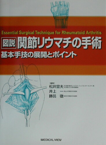 ISBN 9784758306058 図説関節リウマチの手術 基本手技の展開とポイント  /メジカルビュ-社/松井宣夫 メジカルビュー社 本・雑誌・コミック 画像