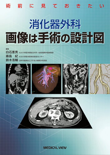 ISBN 9784758316668 術前に見ておきたい消化器外科　画像は手術の設計図/メジカルビュ-社/白石憲男 メジカルビュー社 本・雑誌・コミック 画像