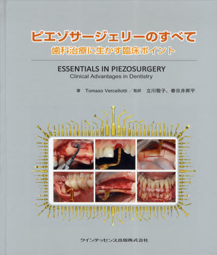 ISBN 9784781200996 ピエゾサ-ジェリ-のすべて 歯科治療に生かす臨床ポイント  /クインテッセンス出版/トマソ・ベルセロッティ クインテッセンス出版 本・雑誌・コミック 画像