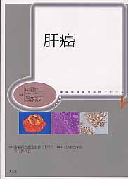 ISBN 9784830622274 肝癌   /文光堂/中沼安二 文光堂 本・雑誌・コミック 画像