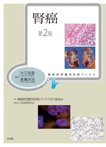 ISBN 9784830622663 腎癌 第2版/文光堂/大江知里 文光堂 本・雑誌・コミック 画像