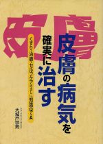 ISBN 9784832701922 皮膚の病気を確実に治す   /保健同人社/大城戸宗男 保健同人社 本・雑誌・コミック 画像