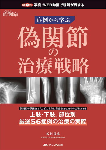 ISBN 9784840478649 偽関節の治療戦略 症例から学ぶ  /メディカ出版/松村福広 メディカ出版 本・雑誌・コミック 画像