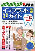 ISBN 9784861640629 インプラント治療なるほどガイド 安心・安全・痛くない 2008秋/海苑社/海苑社 海苑社 本・雑誌・コミック 画像