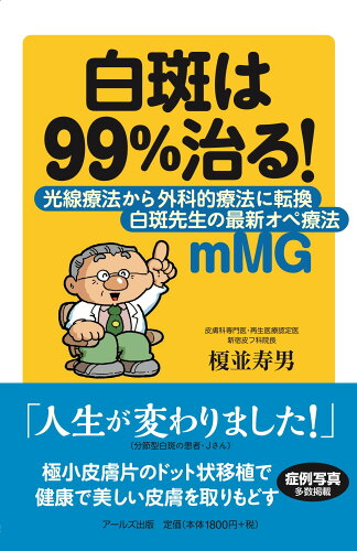 ISBN 9784862043047 白斑は９９％治る！ 光線療法から外科的療法に転換　白斑先生の最新オペ療  /ア-ルズ出版/榎並寿男 アールズ出版 本・雑誌・コミック 画像