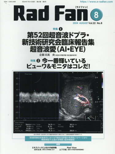 ISBN 9784862912879 Rad Fan 2024 AUGUST（Vol/メディカルアイ 鍬谷書店 本・雑誌・コミック 画像