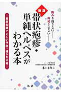 ISBN 9784865130065 新版　帯状疱疹・単純ヘルペスがわかる本   /法研/本田まりこ 法研 本・雑誌・コミック 画像