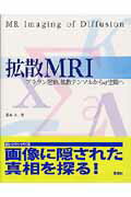 ISBN 9784879623416 拡散ＭＲＩ ブラウン運動，拡散テンソルからｑ空間へ  /学研メディカル秀潤社/荒木力 学研メディカル秀潤社 本・雑誌・コミック 画像