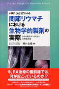 ISBN 9784902380859 手にとるようにわかる関節リウマチにおける生物学的製剤の実際 ５剤の臨床デ-タによる治療最前線  /ベクトル・コア/神戸克明 鍬谷書店 本・雑誌・コミック 画像