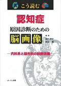 ISBN 9784907095260 こう読む認知症原因診断のための脳画像 内科系と脳外科の診断流儀  /ぱ-そん書房/松田博史 ぱーそん書房 本・雑誌・コミック 画像