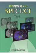 ISBN 9784939028120 核医学を変えるSPECT／CT/ワイリ-・ジャパン/山下康行 鍬谷書店 本・雑誌・コミック 画像