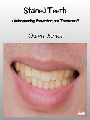 ISBN 9788835468721 Stained Teeth Understanding, Prevention, And Treatment! Owen Jones 本・雑誌・コミック 画像