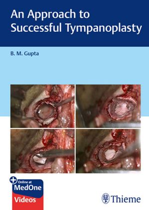 ISBN 9789395390934 An Approach to Successful Tympanoplasty B M Gupta 本・雑誌・コミック 画像